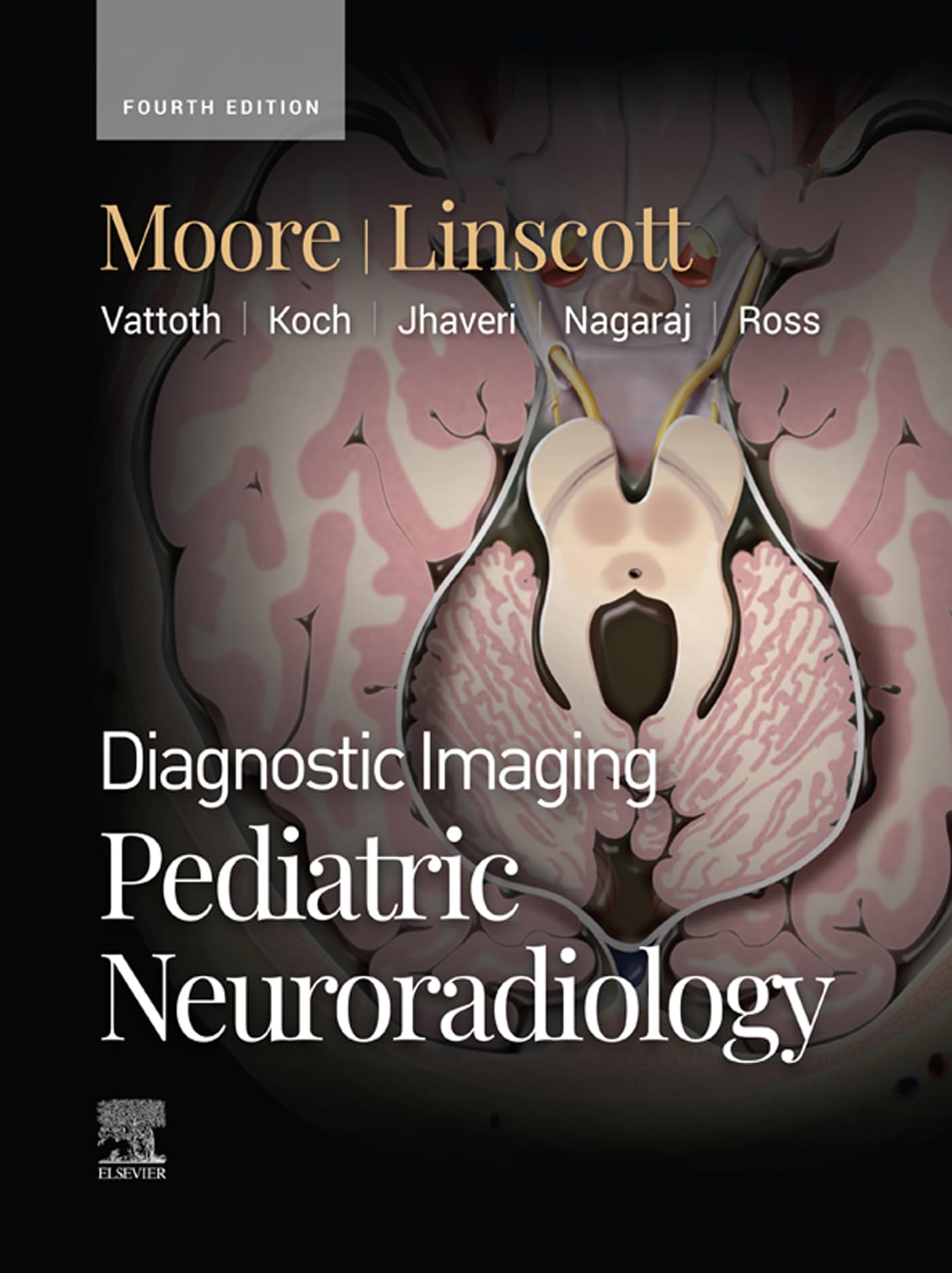 Diagnostic Imaging: Pediatric Neuroradiology - E-BOOK (English Edition)