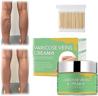 LONGLUAN CremePure Varicose Veins Cream, Best Cream for Varicose Veins, Cremepure Varicose Repair Cream, CremePure Varicose Veins Cream, Creme Vital Varicose Veins Cream (1Pcs)