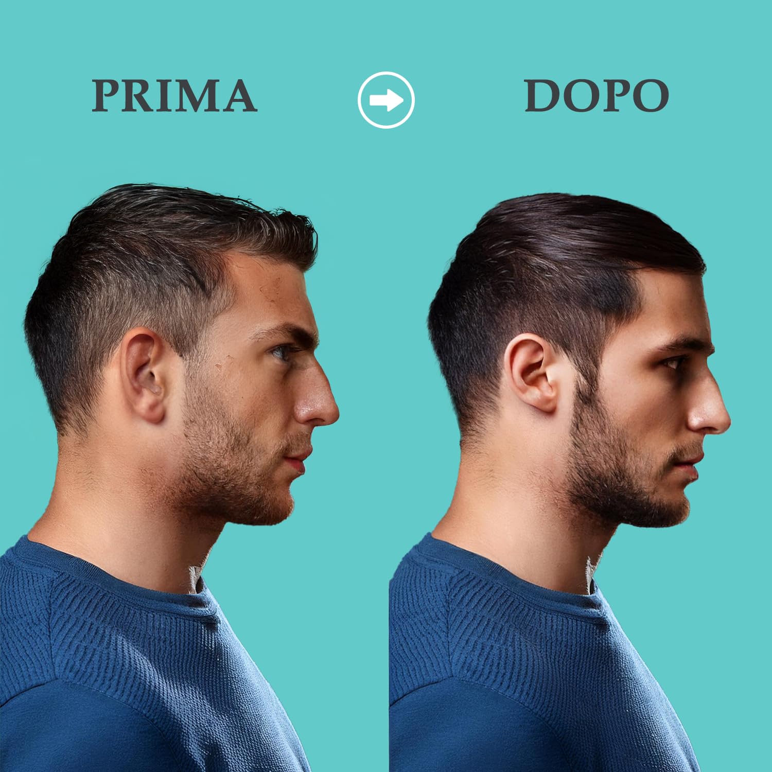 YPHARMA | Tricostamyl Detox Scalp Peeling Lozione per cuoio capelluto - 30 ml - Funzione esfoliante e lenitiva a base di Estratti di Origine Vegetale come Rosmarino, Acidi della Frutta, AHA