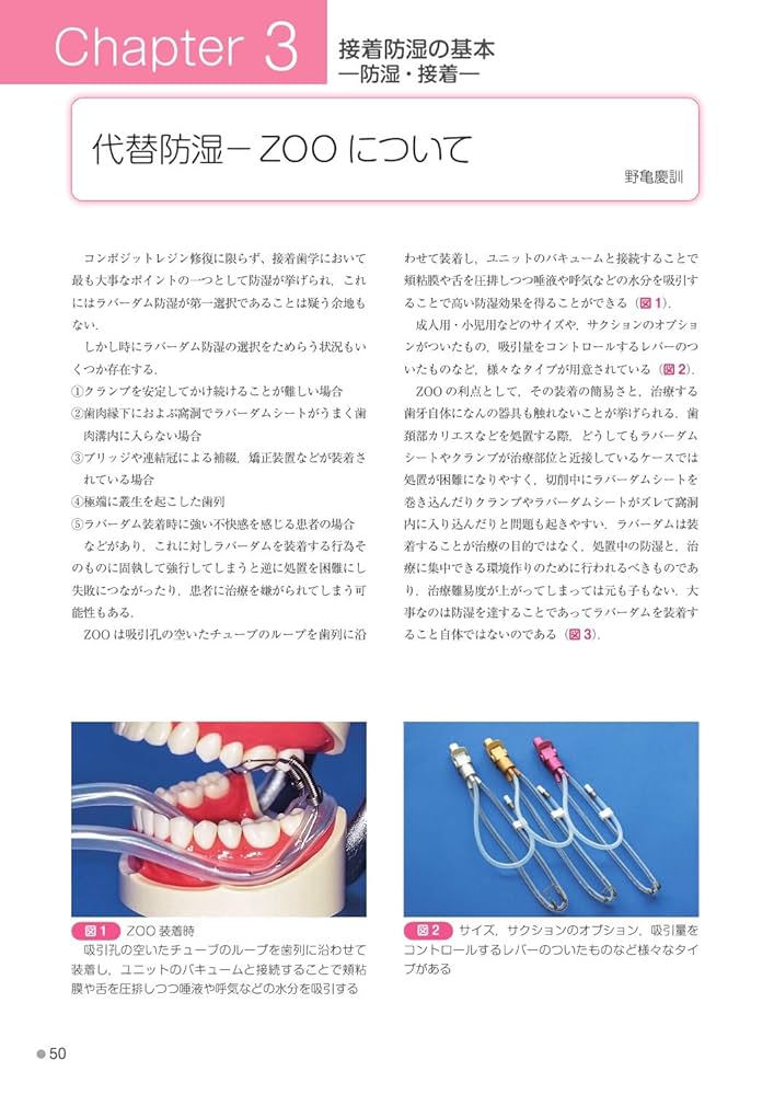 臼歯部コンポジットレジン修復: MI時代の臨床戦略 | 天川 由美子