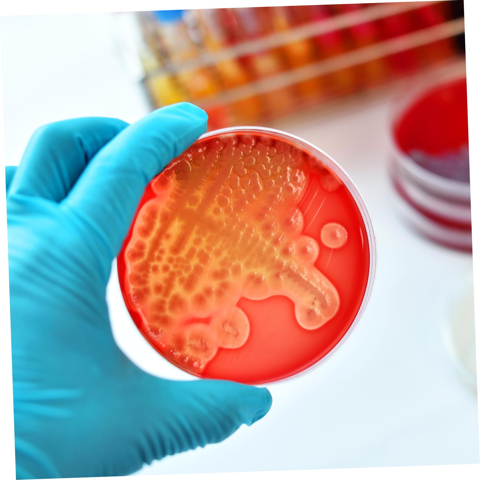 Cabilock Placas de Petri de 7cm con Agar Nutritivo Prevertido 20 Fácil de Transportar y Listas para Usar para Experimentos Científicos en Escuela