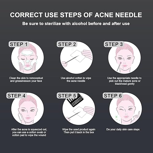 Miniatura 7 de Juego de herramientas de extracción y extracción de espinillas y acné de acero inoxidable, elimina rápida y de forma segura el acné, puntos negros,