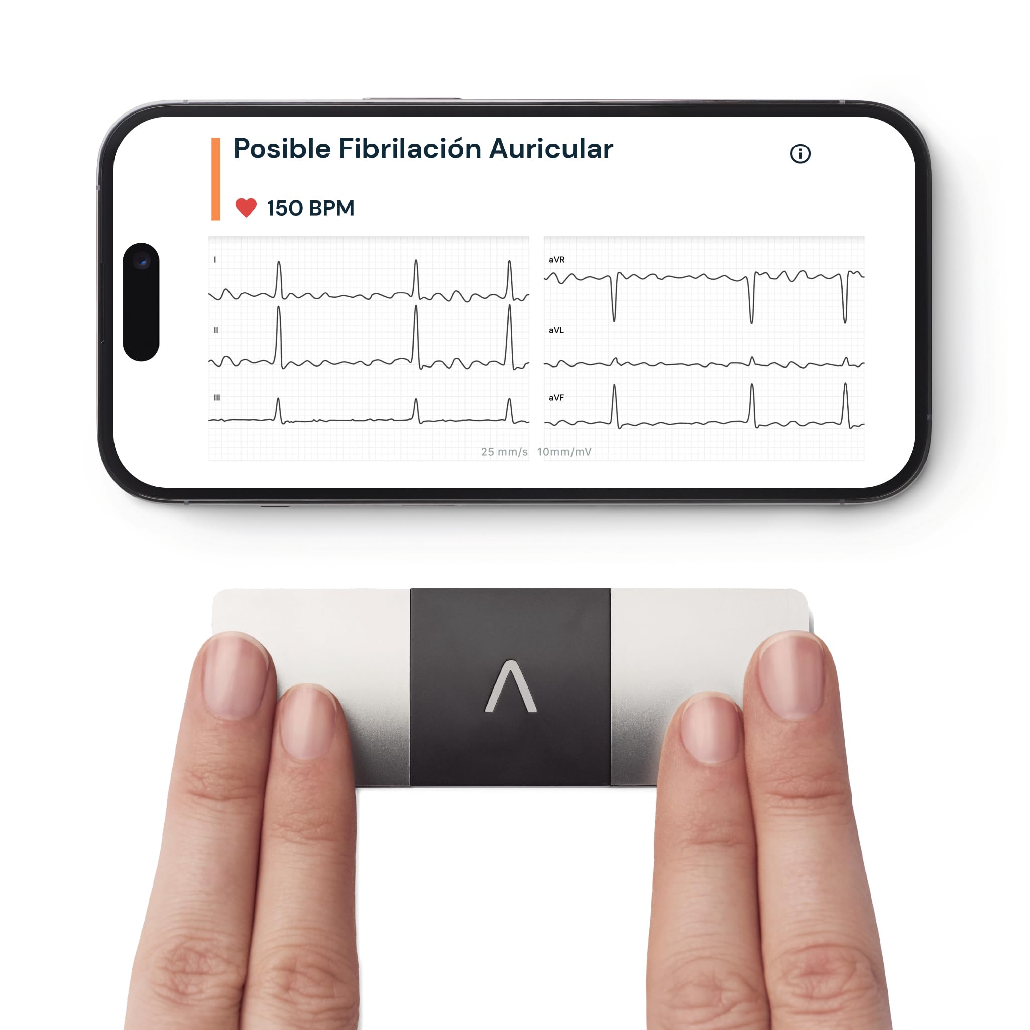 Kardiamobile Electrocardiografo Portatil de 6 derivaciones – Detecta fibrilación Auricular – Resultados instantáneos en 30 Segundos – Funciona con la mayoría de los Smartphones