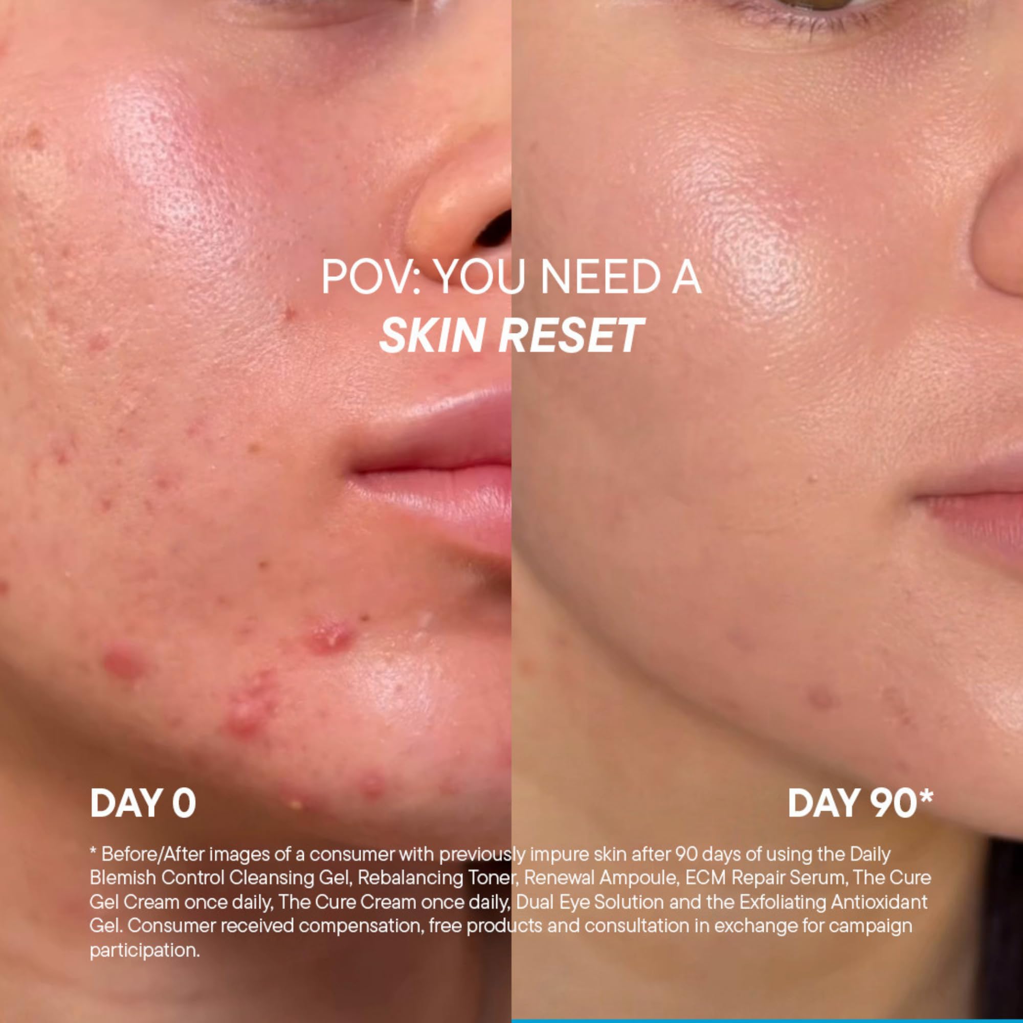 Doctor BABOR Regeneration – The Cure Cream | rewitalizująca pielęgnacja twarzy z 15% ekstraktem z biogenicznego plantacji, działa przeciwzapalnie i przeciwutleniająco, krem do twarzy, szyi i dekoltu,