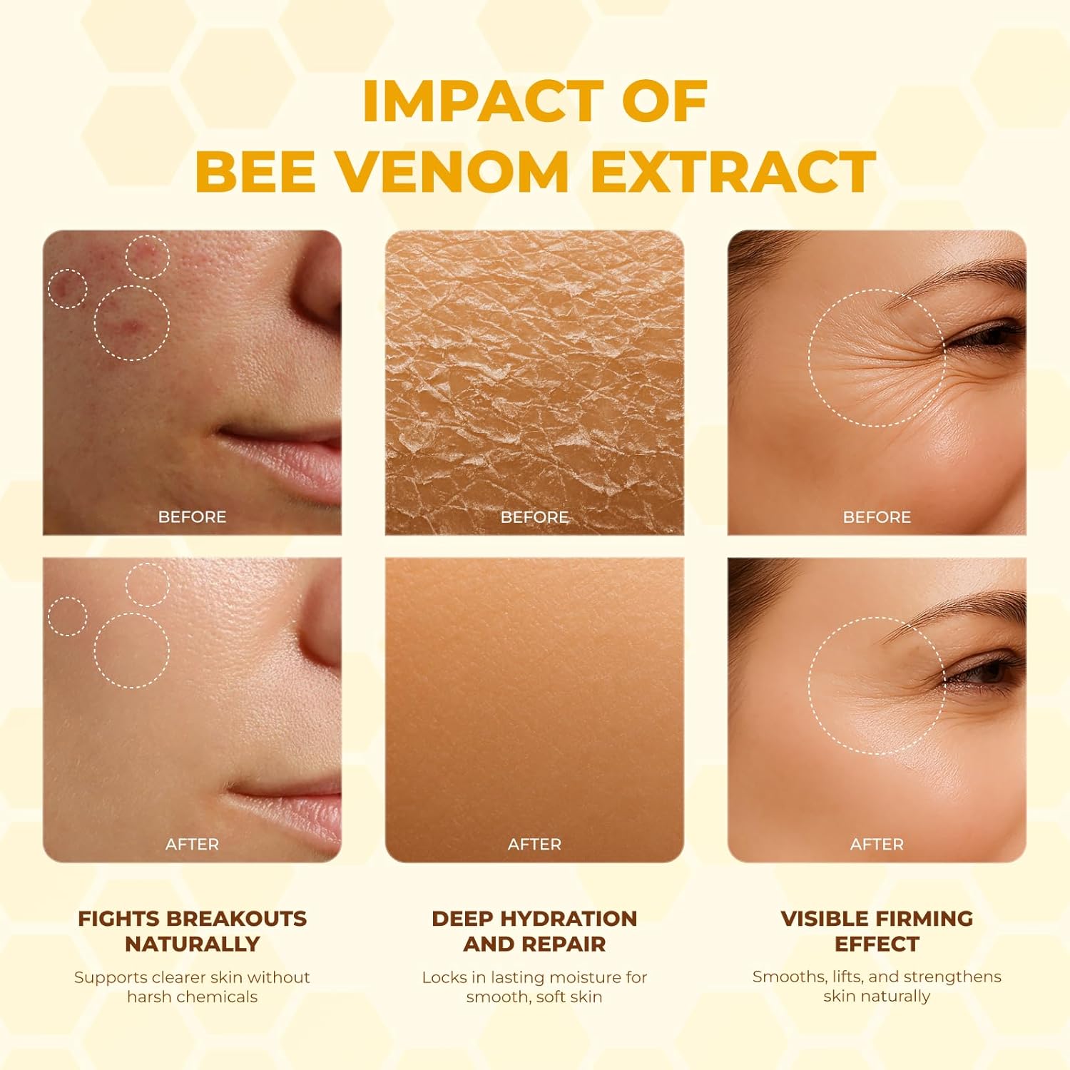 Bee Venom Cream | Hydrating, Smoothing, Firming, Wrinkle-Reducing | Comprehensive Bee Venom Skin Treatment Cream (Enhanced Formula) - Image 4