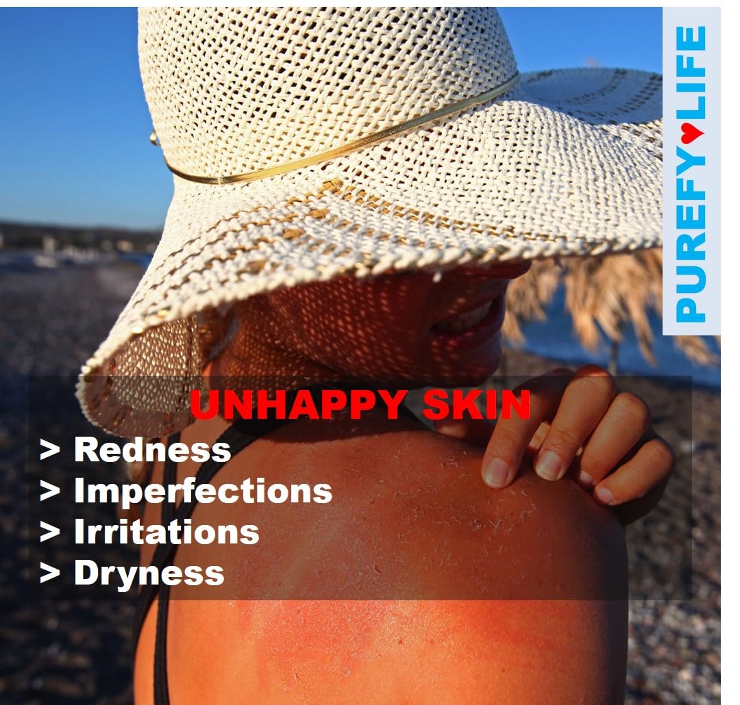 Aerosol tópico (3.4 onzas, 2 unidades) Spray calmante para la piel de la cara y el cuerpo, tecnología Purefypro Dermal HOCL, soporte natural para el cuidado de la piel, enrojecimiento, 3