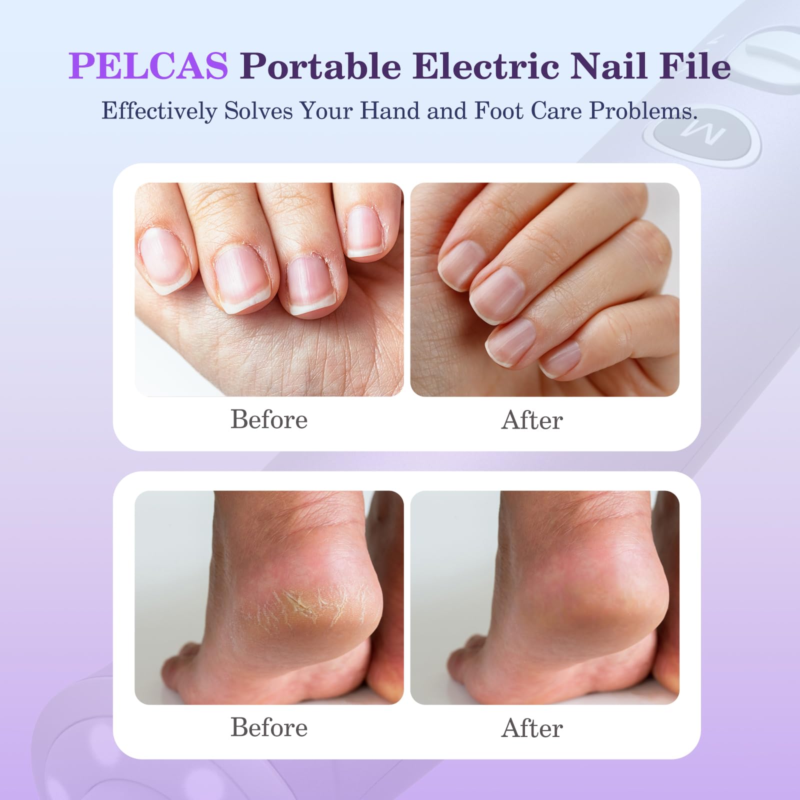 PELCAS Electric Nail Drills, 10 Speeds Cordless Nail File with LED Light, Portable Manicure & Pedicure Kit, Nail Grinder with LCD Screen for Human, Pet, Thick Toenails, Natural & Acrylic Nails Purple - image 2