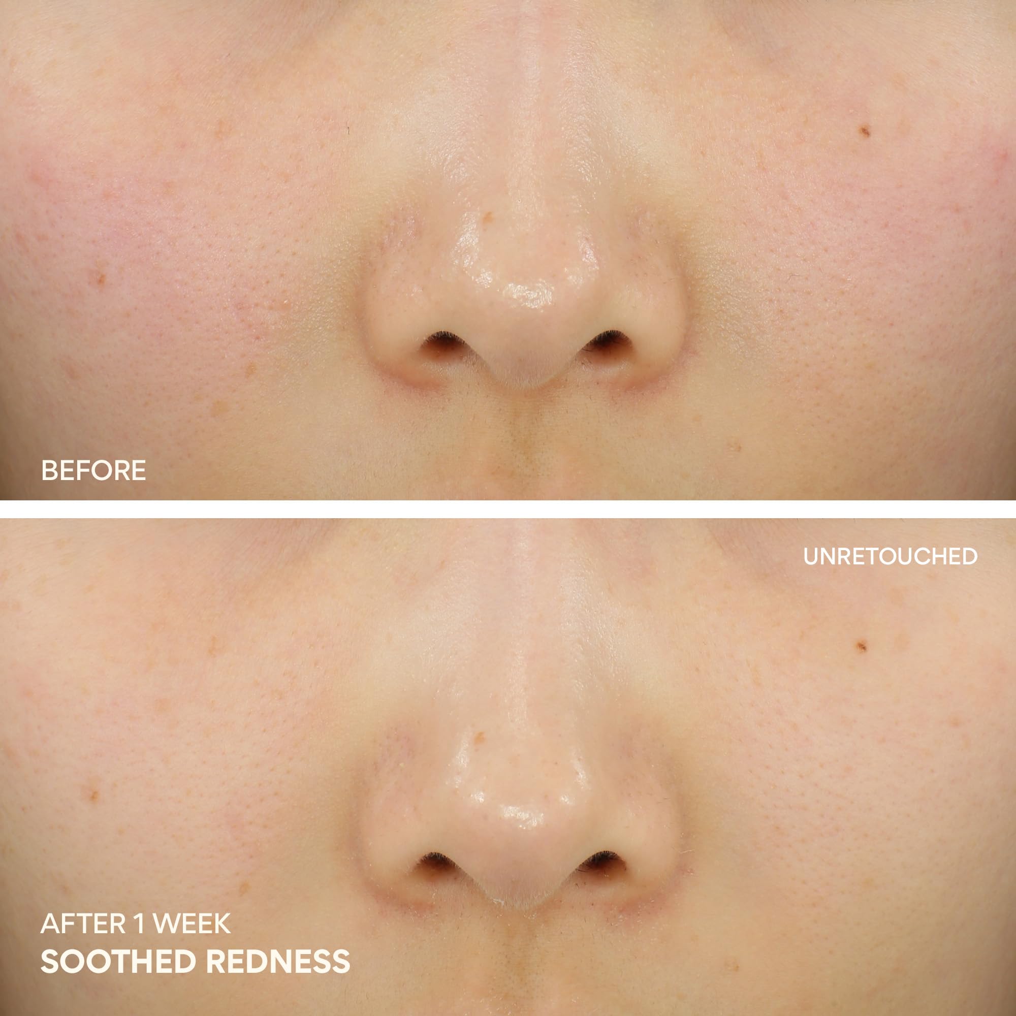 innisfree Green Tea Ceramide Cream, Hydrating Rescue Cream for Dry, Sensitive, and Eczema Prone Skin