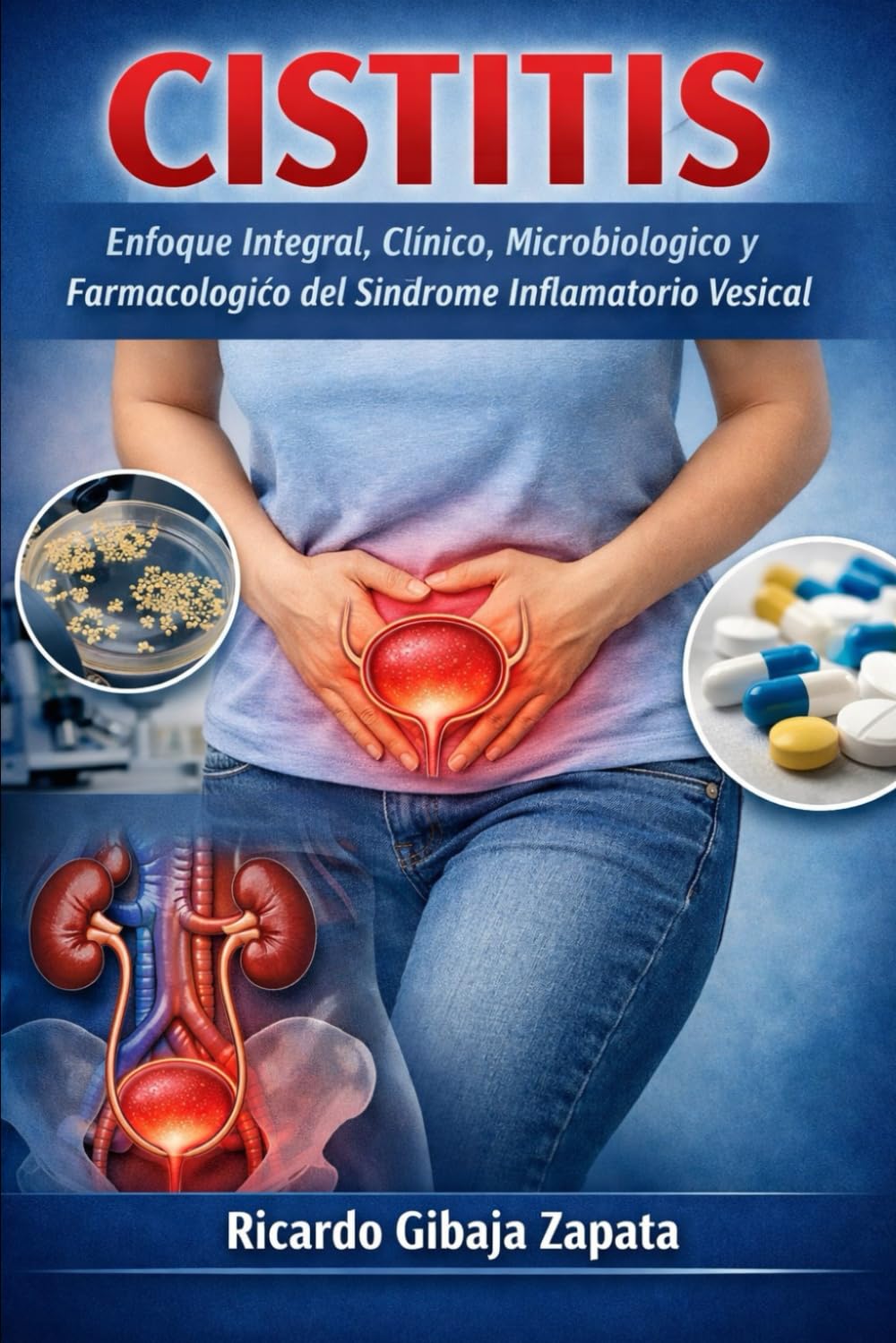 Cistitis: Enfoque Integral, Clínico, Microbiológico y Farmacológico del Síndrome Inflamatorio Vesical