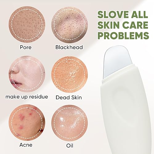 Miniatura 7 de Herramienta removedor de puntos negros, espátula facial, limpiador facial de poros, herramienta para el cuidado de la piel, removedor de cabeza