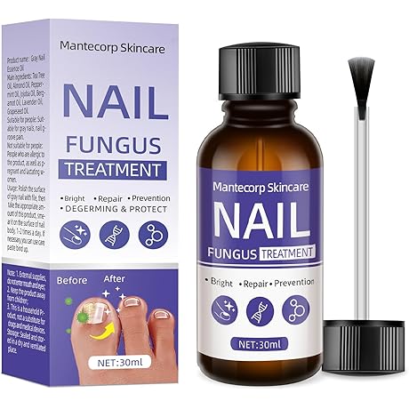 Pure Nails Pro - Toenail Fungus Treatment for a Healthier, More Radiant You