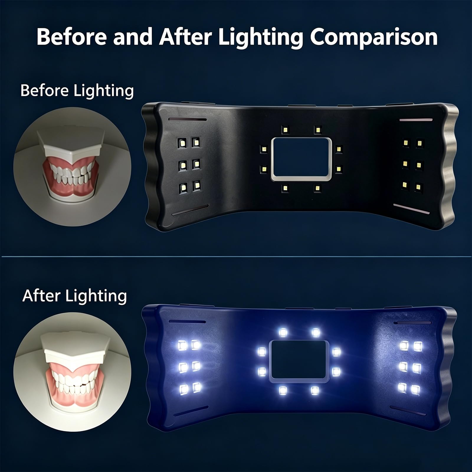 Luce Mobile per Fotografia Dentale, Luce per Fotografia Odontoiatrica, Kit per Fotografia di Otturazioni Dentali con Staffa, 5 Livelli di Luminosità, Intensità Luminosa Fino A 32000 LX per