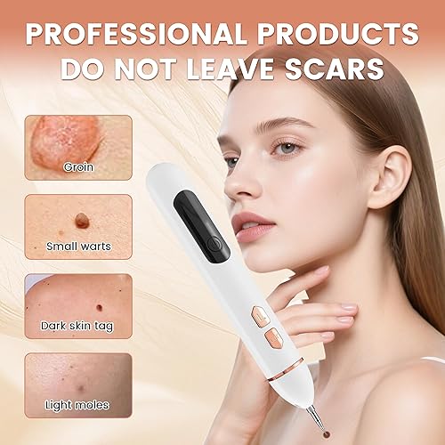 Miniatura 2 de Komzlait Removedor de verrugas para perros, kit de eliminación de verrugas de perro de acción rápida, seguro y fácil de usar, resultados en unos