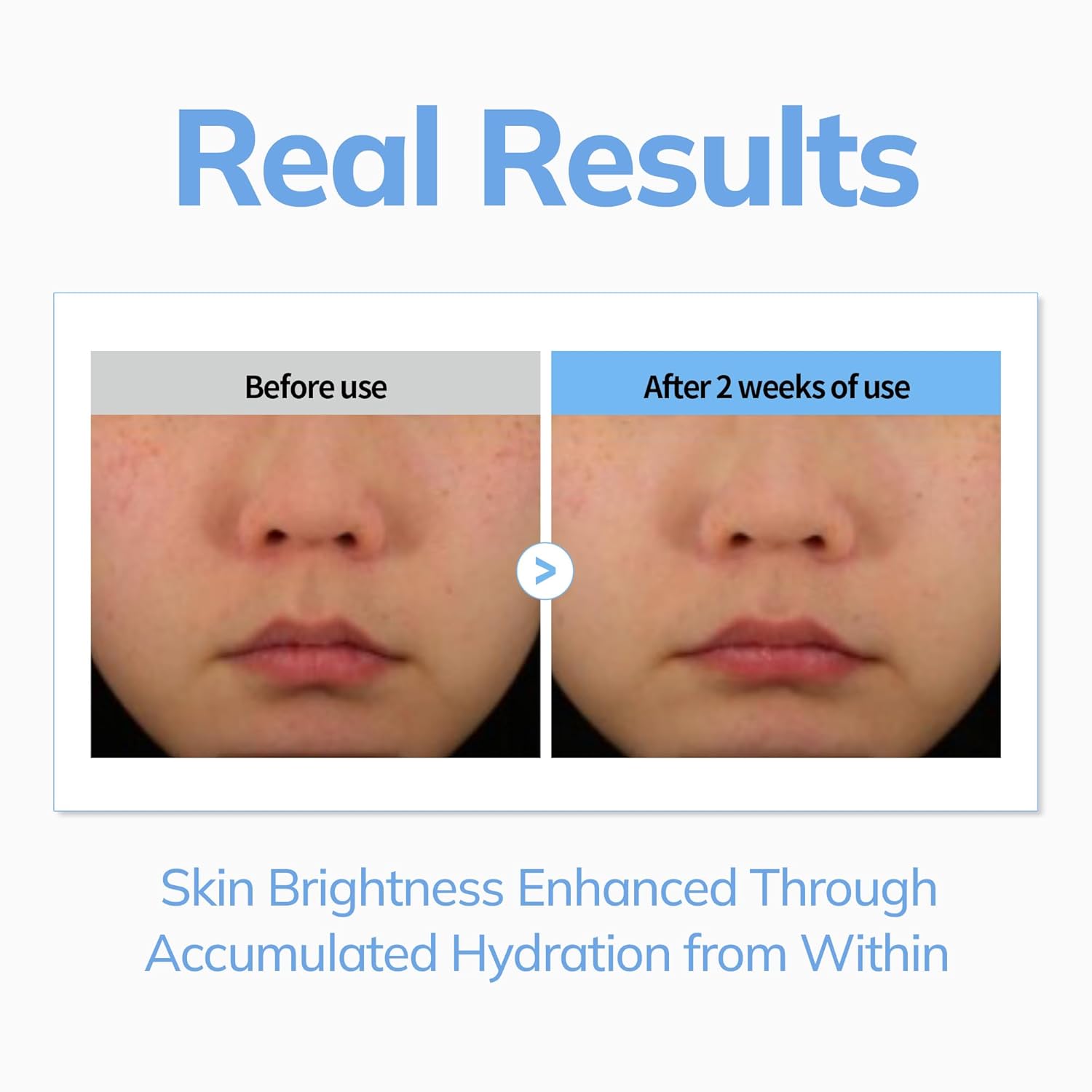 BY MERZY V-Hyaluronic Acid Moisture Ampoule - Hyaluronic Acid, Moisture Boost, Hydration Ampoule, Skin Soothing, All skin type, Serums, Korean Skincare (100ml/3.38 fl.oz.)