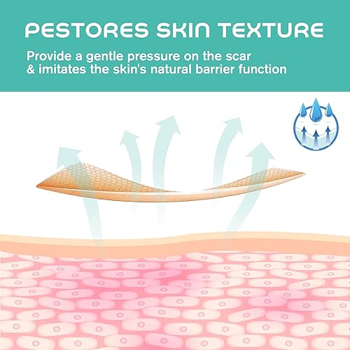 Miniatura 3 de YRVHCK Cinta de silicona suave de grado médico para eliminación de cicatrices (1 x 120 pulgadas), 1 rollo de 70.9 in con hojas de cicatriz de