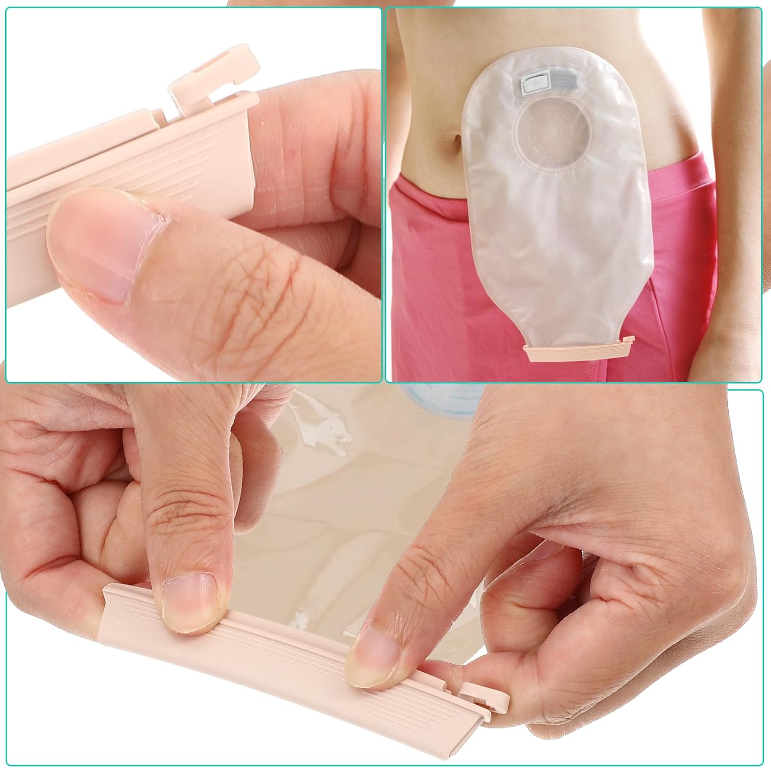 10Pcs Ostomy Bag Clips, Leak-Proof Drainable Pouch Clamps, Reusable Tail Closure Sealing Clip, Ostomy Bag Colostomy Supplies Fistula Accessories