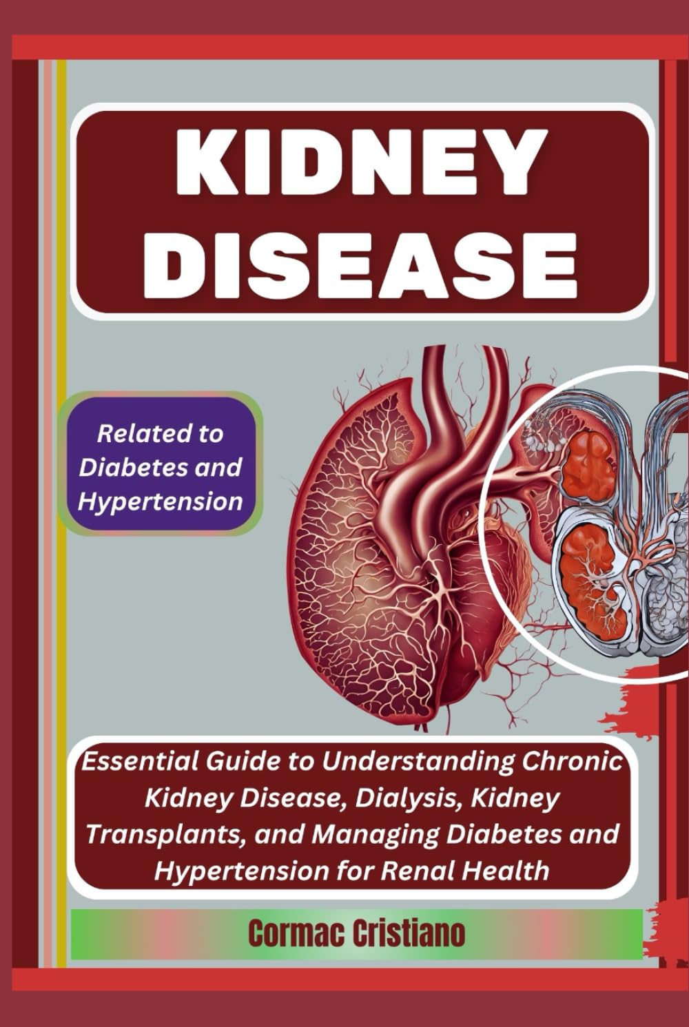KIDNEY DISEASE: Related to Diabetes and Hypertension: Essential Guide to Understanding Chronic Kidney Disease, Dialysis, Kidney Transplants, and Managing Diabetes and Hypertension for Renal Health