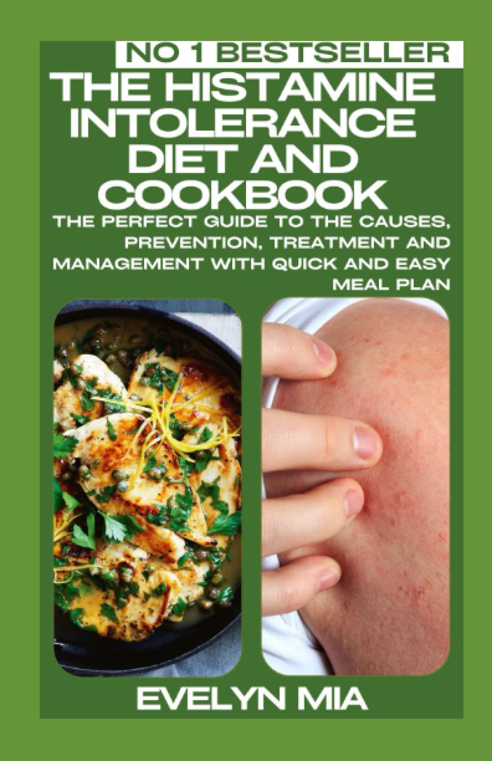 Buy The Histamine Intolerance Diet And Cookbook The Perfect Guide To