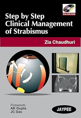 STEP BY STEP CLINICAL MANAGEMENT OF STRABISMUS WITH DVD-ROM