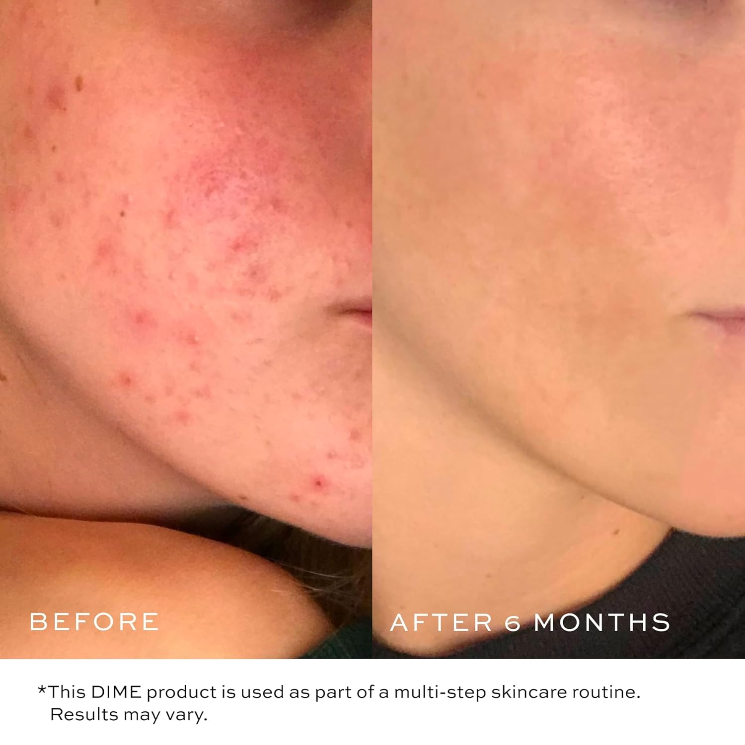 DIME Beauty Gentle Jelly Cleanser, Hydrating Facial Cleanser and Makeup Remover with Vitamin E, Sensitive Skin Face Wash, 4 oz / 120 ml - Image 4