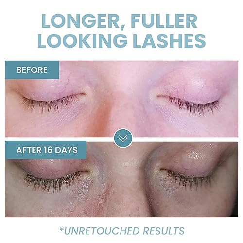 Miniatura 5 de Eva Naturals Aceite de ricino orgánico 20fl oz promueve el crecimiento del cabello las cejas y las pestañas disminuye las arrugas y los signos de