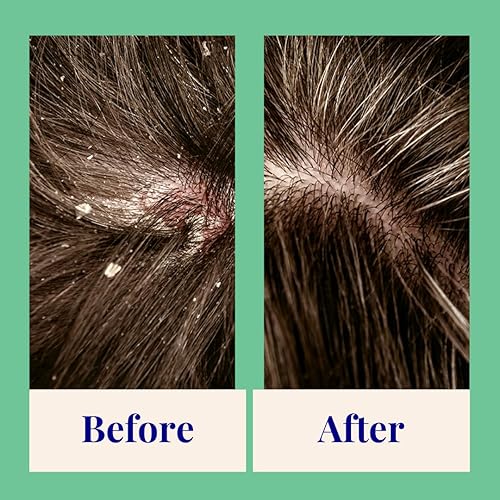 Miniatura 3 de The Powder Shampoo - Champú en Polvo Botella de Aluminio Exfoliante y Equilibrante Champú (Tomillo y Árbol de Té) - 2.47 oz