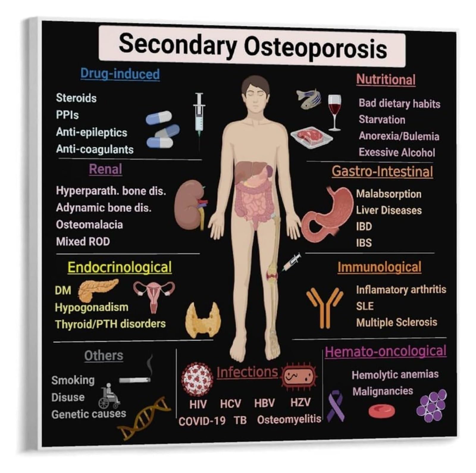 SSOPTMCB Osteoporosis Education Poster - Bone Health Chart on Risk Factors & Nutrition, Reference Wall-Art(Framed,16x24inch(40x60cm))