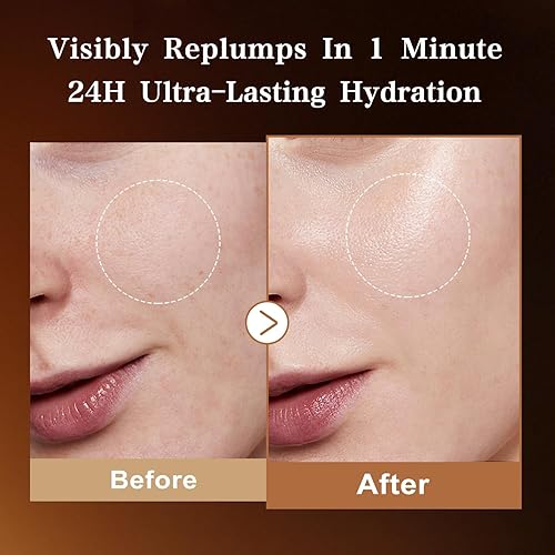 Miniatura 5 de WXMX Suero de ácido hialurónico ultra - 8 formas de HA para hidratación multicapa y soporte de firmeza antienvejecimiento, Matrixyl 3000, colágeno