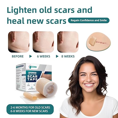 Miniatura 7 de Cinta de silicona para cicatrices quirúrgicas láminas de gel de cicatrices de grado médico para recuperación y tratamiento de abdominoplastia de