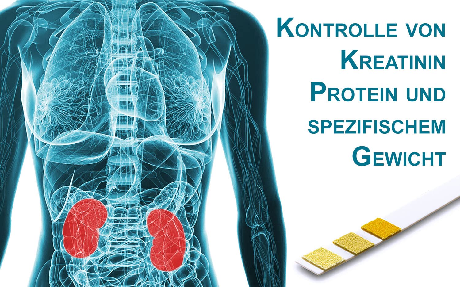 One+Step Nierentest 5 Stück - Urin Teststreifen zur Kontolle von Kreatinin, Protein und spezifisches Gewicht