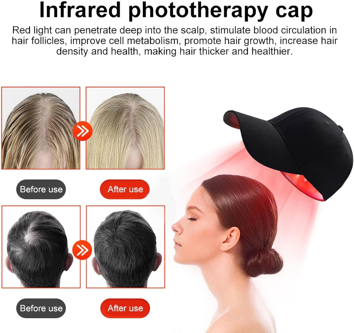 Cappuccetto a Luce Rossa, Cappello a Luce Rossa Per Testa, Tappo Di Crescita Dei Capelli Portatile, LED Da 215 Pcs, Dimensioni Da 660 Nm a 850 Nm Di Luce a Infrarossi, Per La Perdita Di Capelli