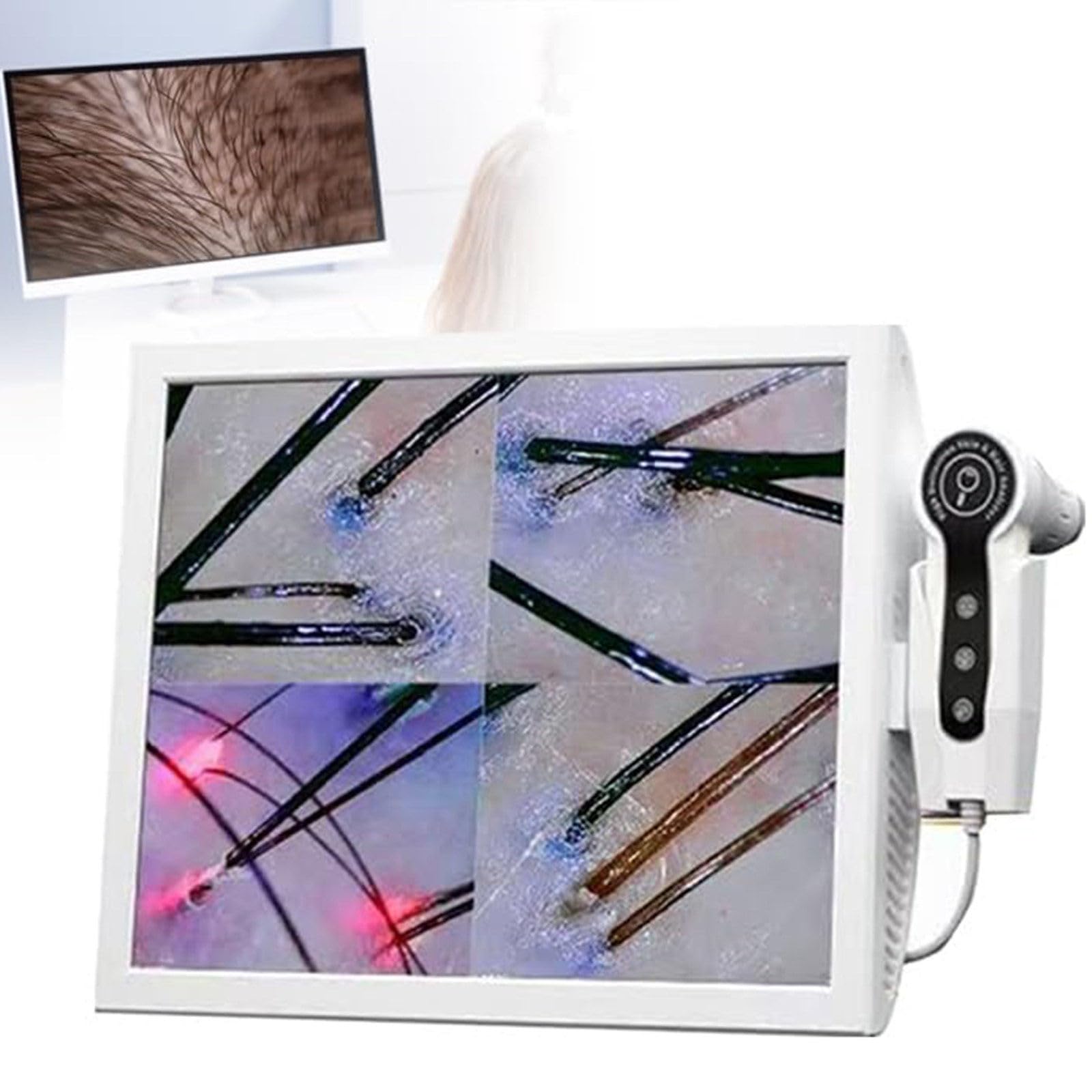 Hair Analyzer Scalp Detector with 70x/200x Lenses Magnification for Scalp and Hair Follicle Inspection, Oil and Moisture Detection, Professional Skin Diagnostic Tool with 15 Inch HD LCD Screen