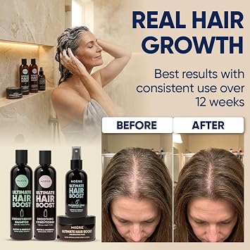 Moerie Hair Growth Shampoo, Conditioner, Spray and Mask for Men and Women, Hair Loss Solution with Biotin and Rosemary, Thickening Hair Regrowth Set with Serum Level Care for Thinning Hair, 8 Set