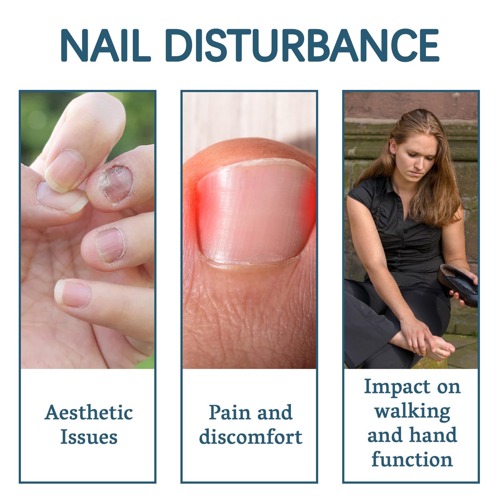Extra Strong Nail Fungal Treatment for Toenail Anti Fungal Nail Extra Strong, Toe Nail Treatment ExtraStrong, Nails Repair - Image 3