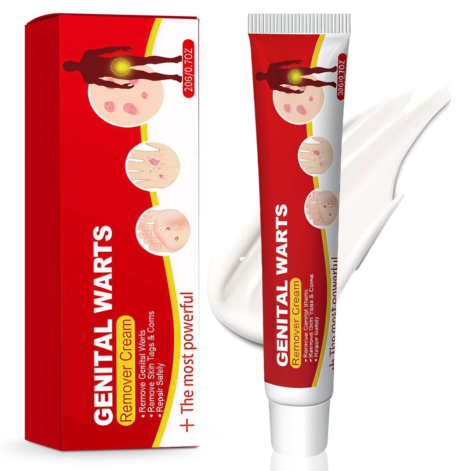 20g Eliminador De La Piel Verrugas Crema, Eliminación las Verrugas en los pies, Manos y Cuerpo, Atención Diaria, Adecuado para Partes del cuerpo