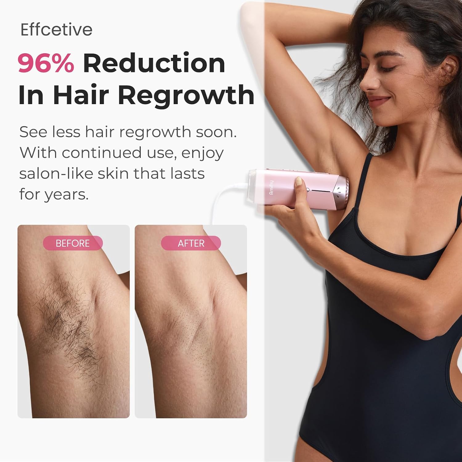 Ice Cooling IPL Laser Hair Removal Device Home Use, Auto-detect Skin Tone Hair Removal Machine for Women Men, 3 Energy Levels & 2 Modes, Face Body Use with Razor & Glasses