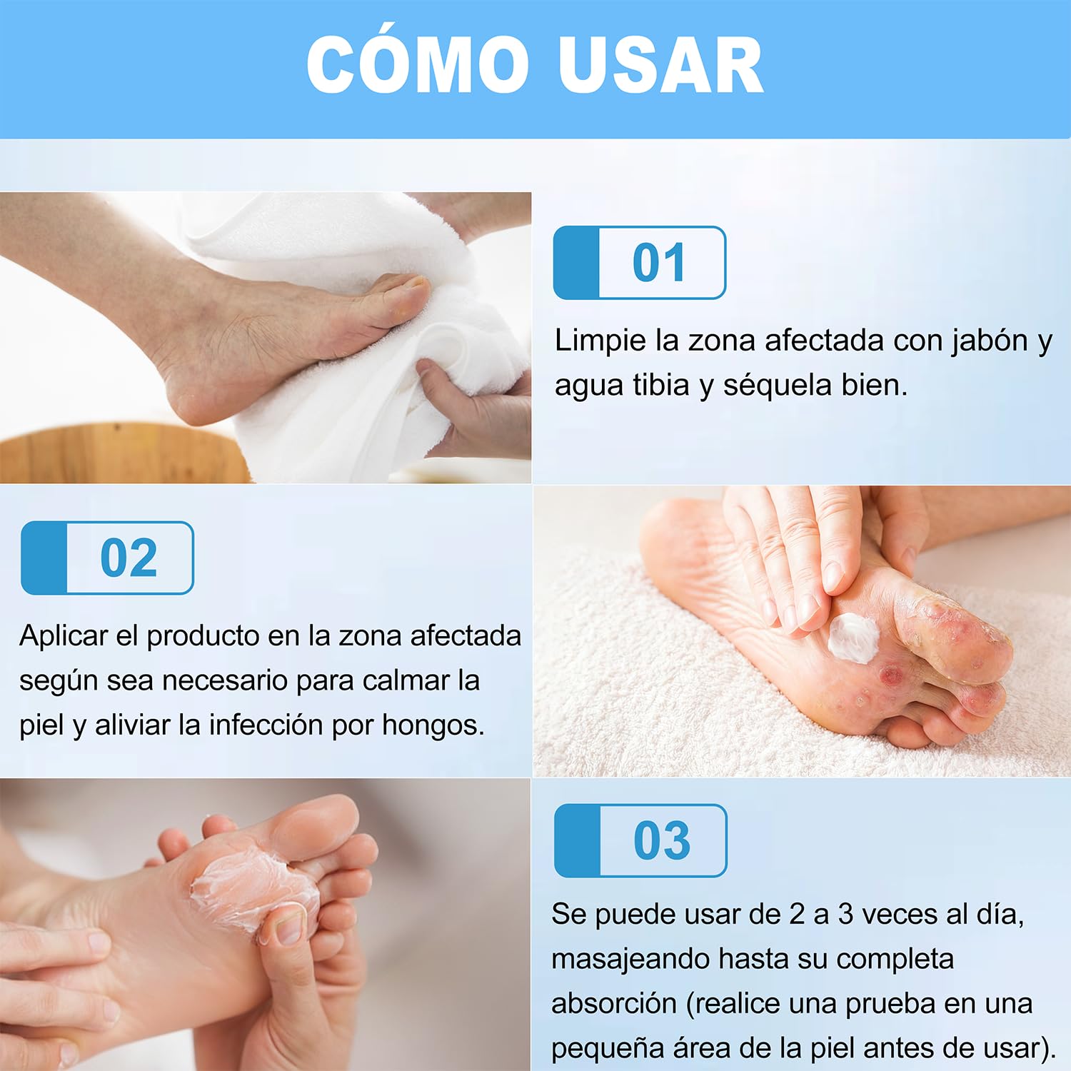 Crema Antifúngica - Crema Antifúngica para la Piel, Crema antimicótica para hongos pies y pie de atleta Calma los picazones y el malestar cutáneo, fórmula natural (1) — view 6