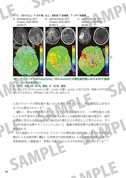 MRI一問一答: 撮像法選択と読影に“必ず”役立つ基礎知識 (Gakken