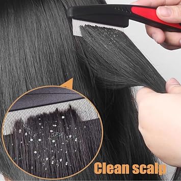 Dandruff Comb, Fine Tooth Scalp Comb Dandruff Massage Lice Comb Stainless Steel Hair Care Tool Brown Red