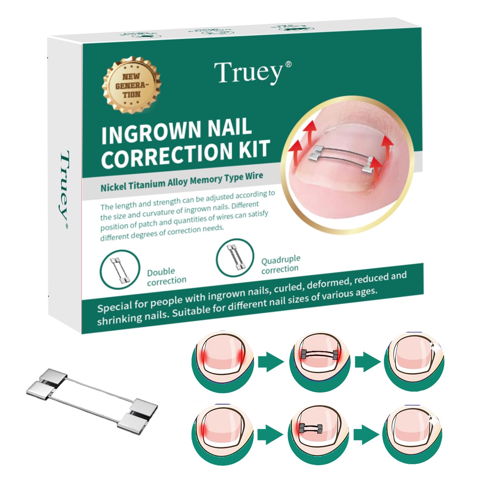 Truey Cuttable Titanium Alloy Silicone Ingrown Toenail Treatment,Designed for Curved Nail Repair, Ingrown Toenail Corrector at Home,Ingrown Toenail Removal Kit, Adjustable for Any nail Sizes,reusable