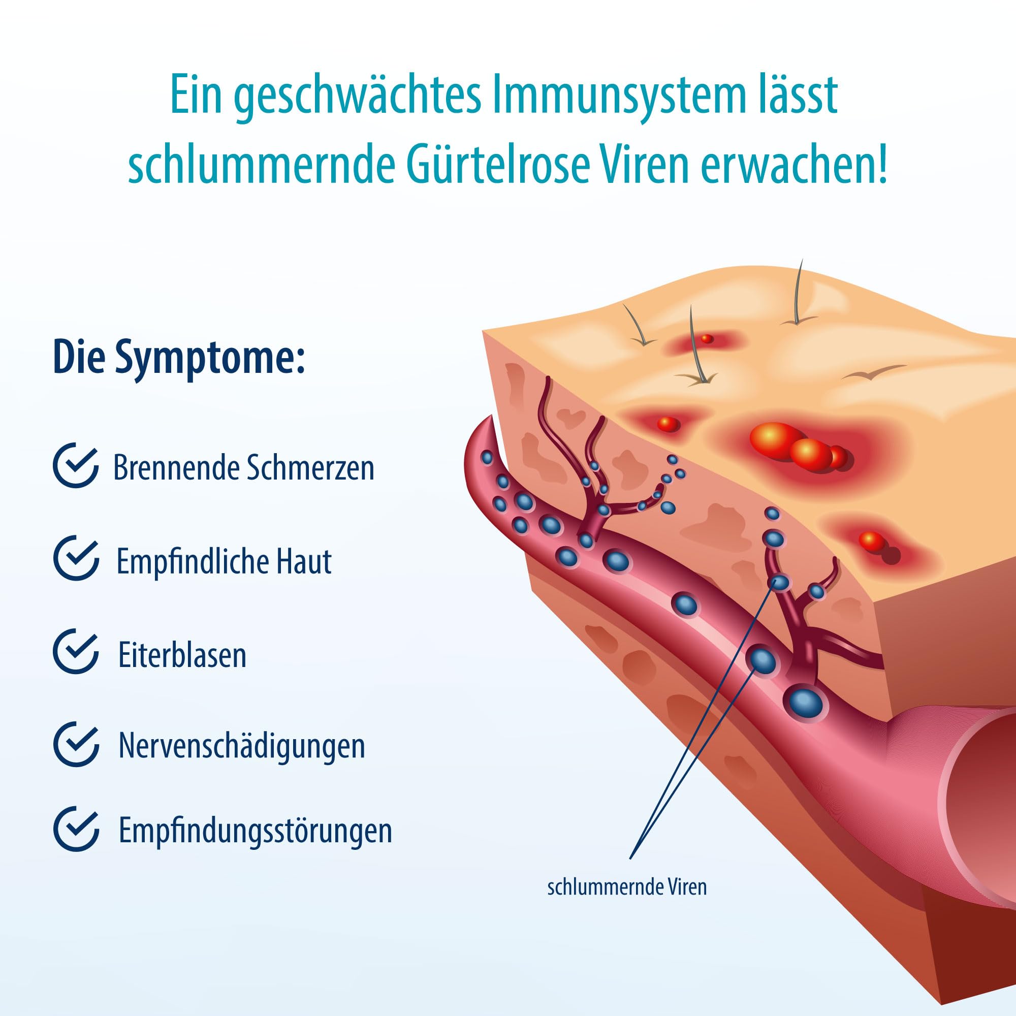 Herpasogel bei Gürtelrose | Fördert die Normalisierung der Haut bei Herpes zoster | Reich an natürlichen funktionellen Inhaltsstoffen