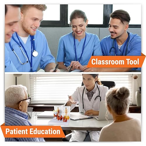 Miniatura 3 de Modelo de enfermedad de la tiroides G315