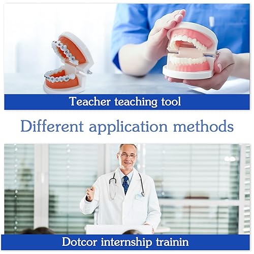 Miniatura 6 de Modelo de dientes de ortodoncia dental con aparatos ortopédicos coloridos, modelo profesional de boca de dentadura para demostración de estudio para