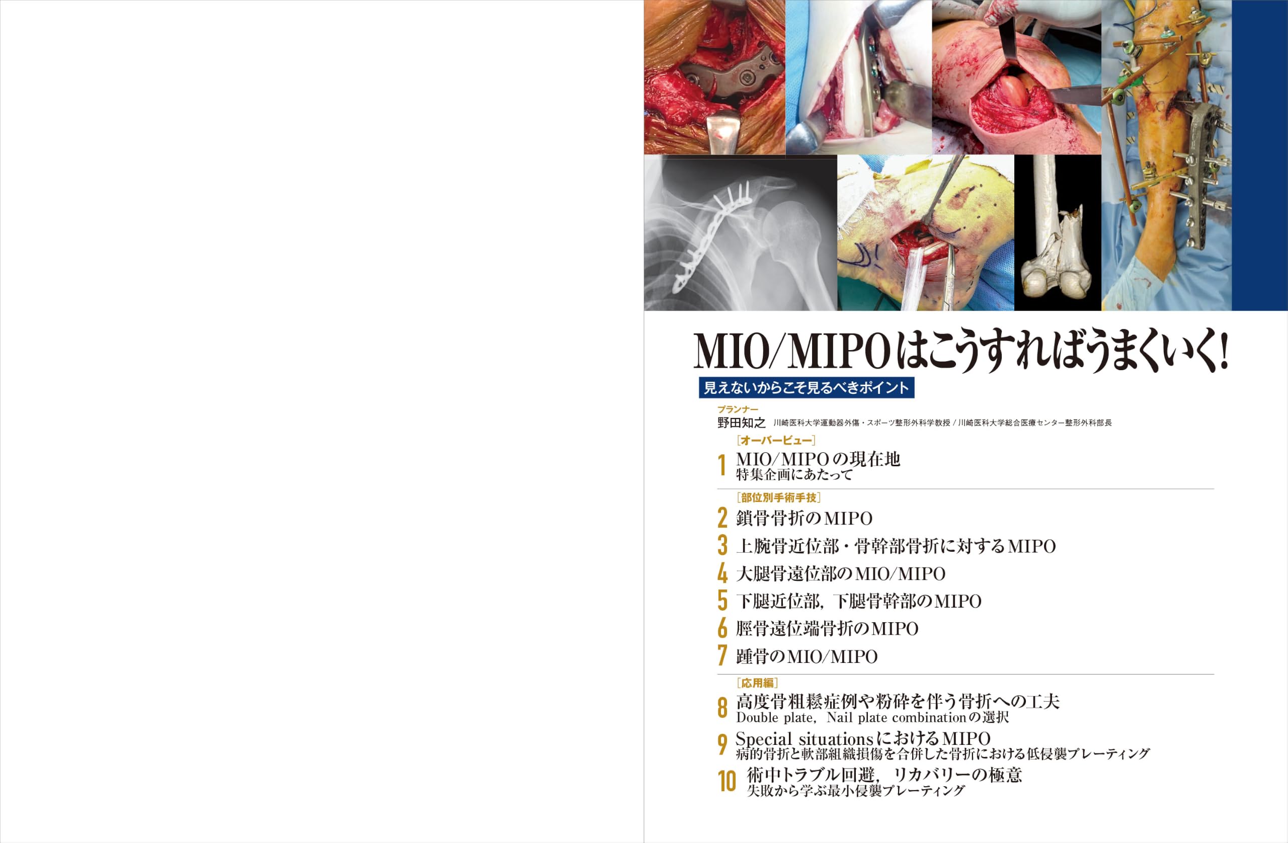 Amazon.co.jp: 整形外科サージカルテクニック編集室: 本