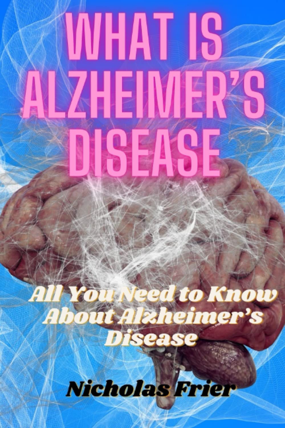 What is Alzheimer's Disease: All You Need to Know About Alzheimer’s Disease