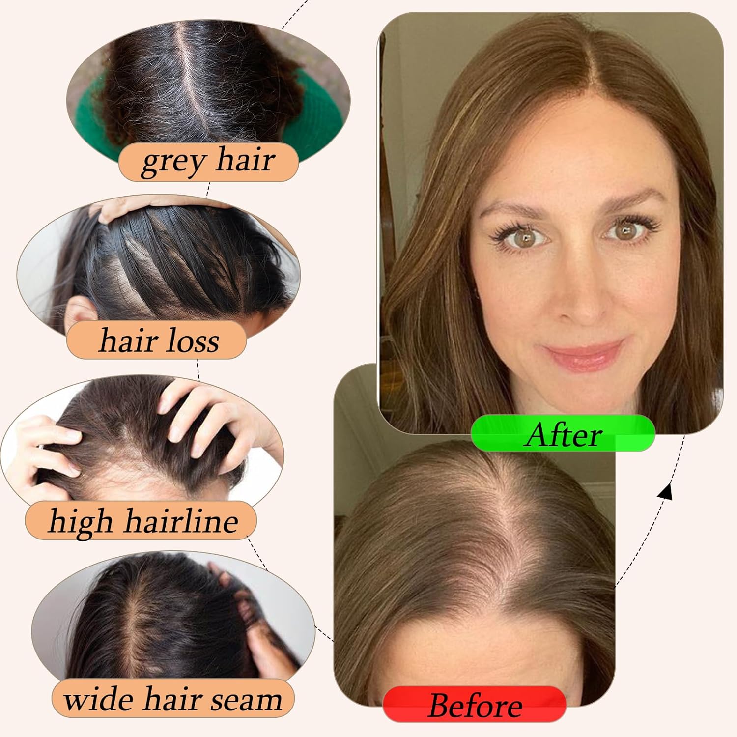 Human Hair Toppers for Women with Thinning Hair Real Human Topper Crown No Bangs 10 Inch #2 Dark Brown