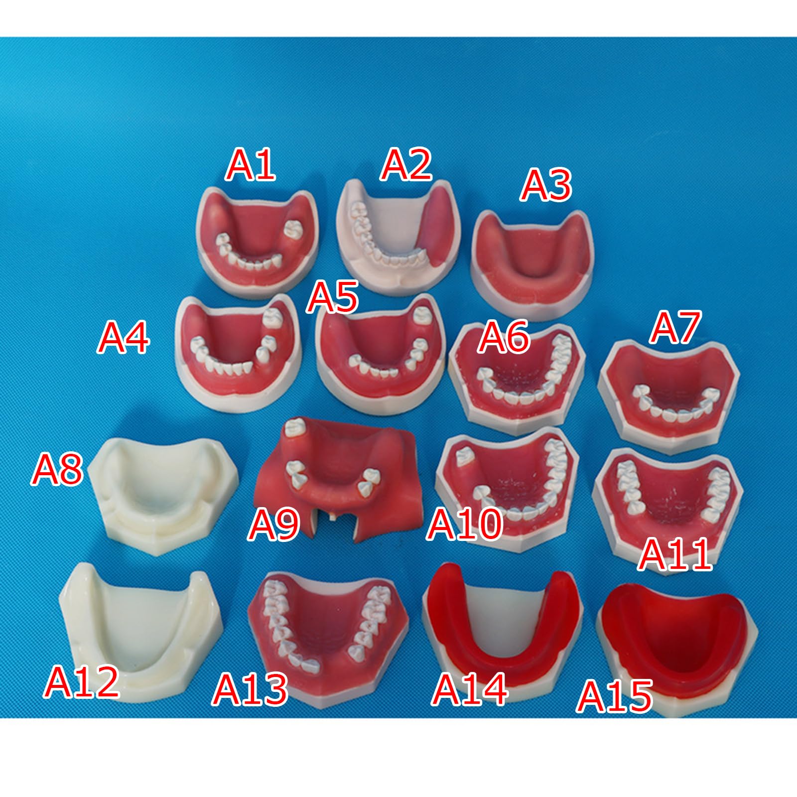 Modello di impianto Dentale - Modello di impianto mandibolare Medico e odontoiatrico - per Studio didattico Displaymedical Model,A14-8cm