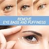 2 Pcs Chalazion & Blepharitis Treatment Eye Cream, Chalazion Eye Treatment Cream, Eye Creams for Dry Eyelids, Eye Cream for Dark Circles And Puffy Eye Bags & Puffiness, Stye Eye for All Skin Types