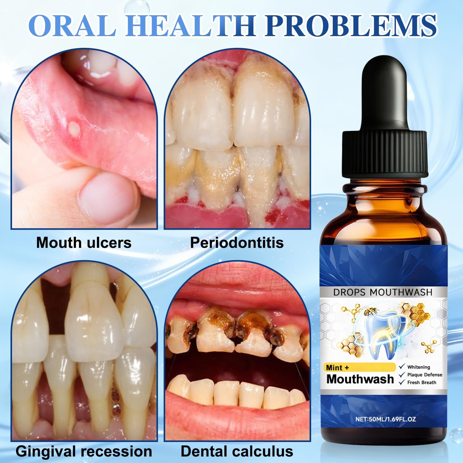 2PCS Beetakt Oral Repair Solution, Mint Flavored Oral Mouthwash, Professional Gum Restore Drops, Teeth Restoration, Effectively Improves Oral Hygiene and Freshens Breath
