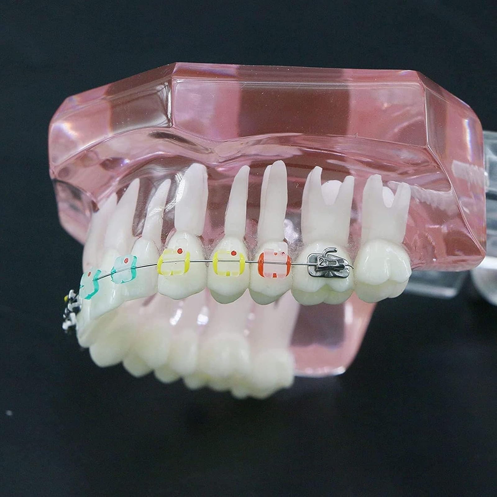 Zahnärztliches kieferorthopädisches Demonstrationsmodell,kieferorthopädisches Retainer-Behandlungsmodell für Zahnzähne mit selbstligierenden Metallklammern,die das Modell erklären